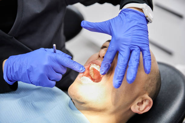 Best Emergency Root Canal Treatment in Grass Lake, MI